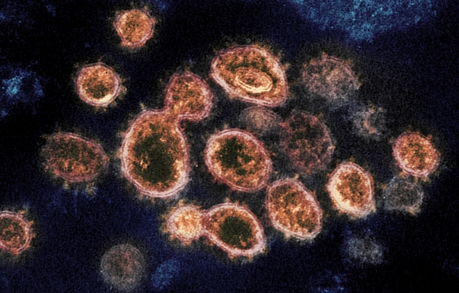 코로나19 바이러스 전자현미경 이미지 미국 국립 알레르기 감염병 연구소(NIAID) 제공