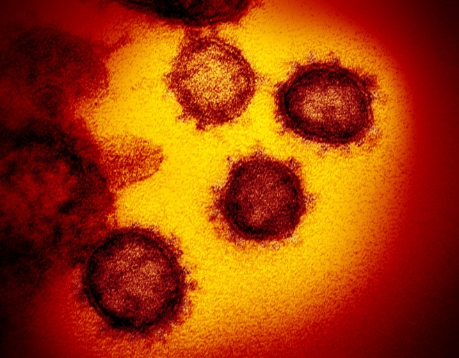 코로나19 바이러스 전자현미경 이미지 미국 국립 알레르기 감염병 연구소(NIAID) 제공