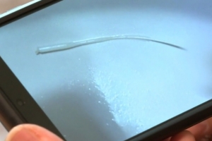 5살 아이 코로나 검사 중 콧속에서 부러진 면봉…“식도 넘어갔다 배출”