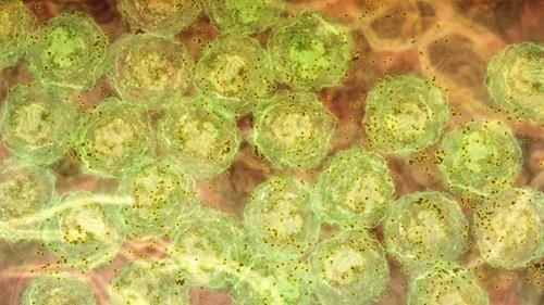 염증 신호를 받아 항체(갈색)를 형성하는 B세포(녹색). 호주 월터 & 엘리자 홀 의학 연구소