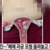간호조무사 배에 ‘자궁 모형’ 올리고 ‘찰칵’…한의사 “강제성 없어”