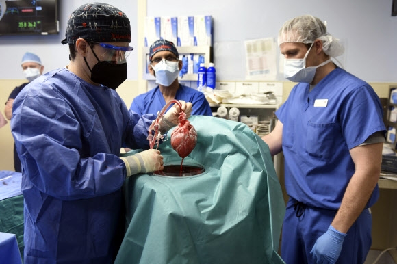 미국 메릴랜드대 의대가 지난 7일(현지시간) 세계 최초로 유전자를 변형한 돼지 심장을 사람에게 이식하는 수술을 완료한 가운데, 의료진이 이식에 사용된 심장을 들어 보이고 있다.  볼티모어 메릴랜드대 의대 제공