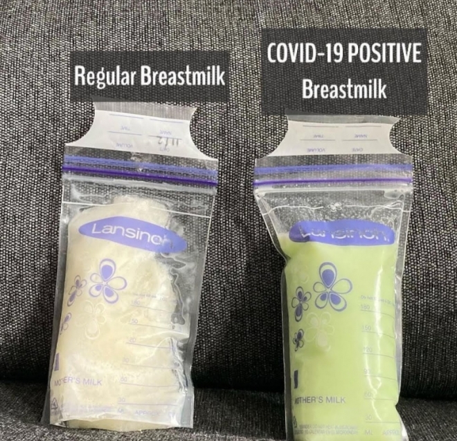 평소 모유 색깔(왼쪽)과 코로나19 양성 반응을 보인 후 연녹색으로 변한 모유 색깔. 더 선 캡처
