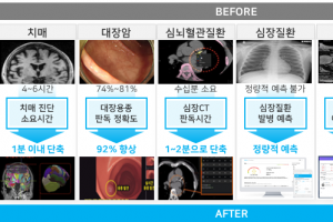 文대통령 정상회담 성과로 AI 주치의 ‘닥터앤서’ 사우디 간다