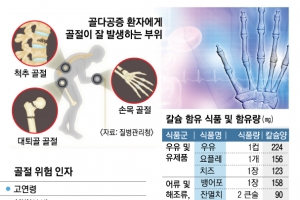 골다공증 얕보다간 치명상… 칼슘·비타민D 미리미리 챙기세요