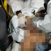 밤에 수영한다며 바다들어간 30대 남성 70대 주민이 뛰어들어 구조