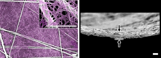 인공장기에 쓰이는 인공 세포외기질 박막 개발 나노섬유로 강화된 신축성 있는 세포외기질 박막(보라색:콜라겐, 회색:나노섬유)  포스텍 제공