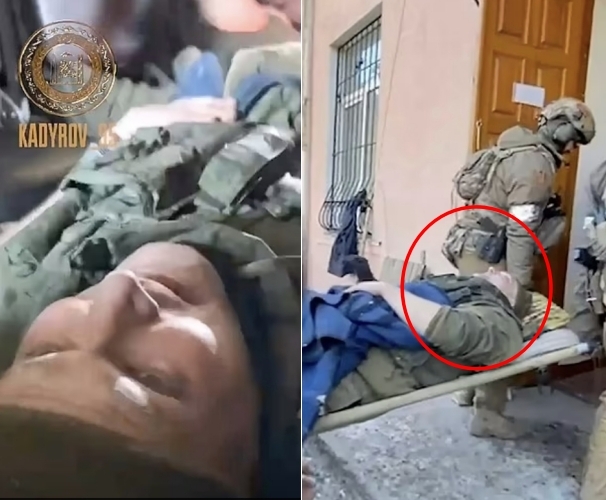 23일 러시아군의 유리 메드베데프 대령으로 알려진 장교가 양다리에 중상을 입고 들것에 실려 병원으로 들어가는 영상이 공개됐다. 2022.03.26 east2west.news