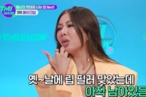 제시, 입술 성형 의혹에 “나올 때마다 괴물 된다고…”