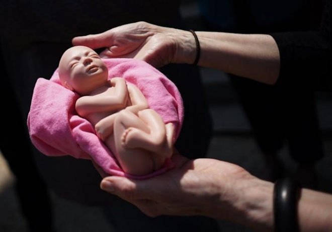 미국의 낙태 반대 활동가가 지난 2015년 5월 7일(현지시간) 워싱턴DC에서 열린 집회 도중 태아 모양 인형을 손으로 들어 보이고 있다. USA 투데이 홈페이지 캡처