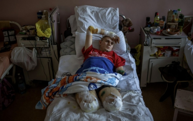 전쟁으로 두 다리를 잃고 써드시티 병원 침대에 누워있는 환자의 모습. 에밀리오 모레나티 AP통신 사진기자 제공