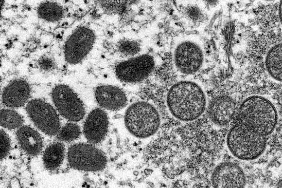 현미경으로 들여다본 원숭이두창 바이러스