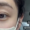 ‘안면마비’ 최희, 활동 중단…“재활 매진”