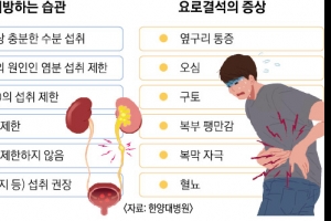 산통 버금가는 ‘요로결석’ 고통… 땀 많이 흘리는 여름철 최대 복병