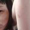 40세 안영미, 면역력 떨어져 상처난 피부…“건강 꼭 챙기기”