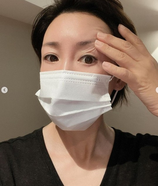 이상아가 성형 수술을 한 사실을 공개했다. SNS 캡처 