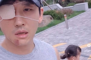 유명 男가수 안면마비 “말초신경까지 염증”
