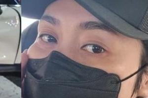 가수 춘자, 심각한 교통사고 당했다