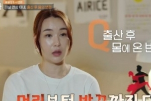 배윤정, 머리카락 우수수 빠졌다