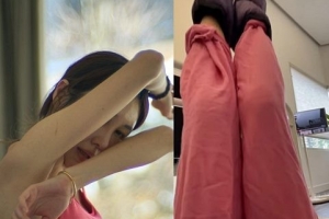 ‘엄태웅♥’ 윤혜진, 말라도 너무 마른 근황