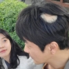 ‘손태영♥’ 권상우, 원형 탈모 어쩌나…손바닥만 하네