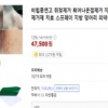 쥐젖제거 제품은 모두 불법, 함부로 제거 마세요