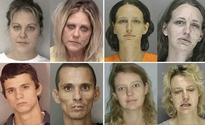 마약 중독자들의 얼굴 변화 멀트노머 카운티 셰리프 사무소