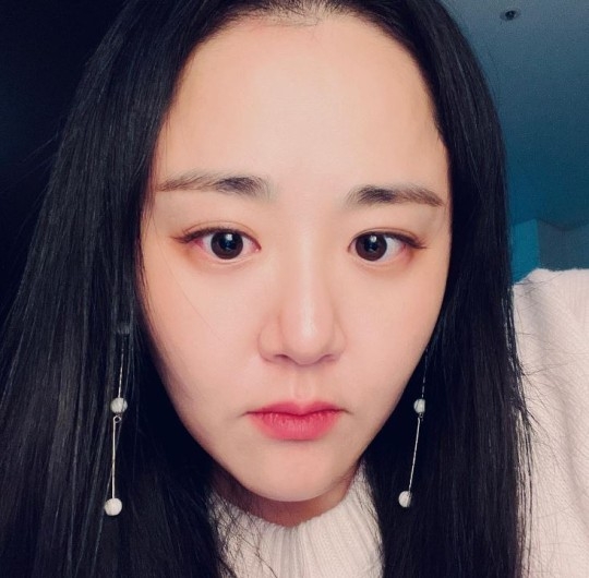 배우 문근영. SNS 캡처