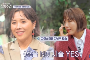 신봉선, ‘눈가시술’ 후 달라진 얼굴