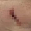 “손 영구손상 위험”…주호민, 강도 피해 사진