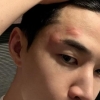 헨리, 퉁퉁 부은 얼굴…“최악, 복수할 수도 없고”