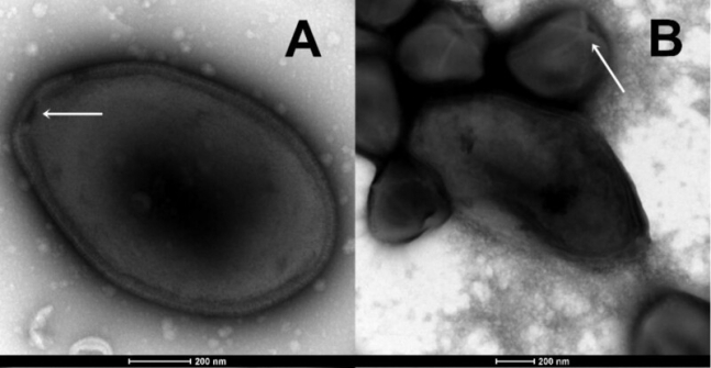 4만 8500년이 지난 후에도 감염력을 유지하고 있는 영구동토층의 판도라 바이러스(왼쪽). 오른쪽은 판도라 바이러스와 이보다는 작은 또 다른 거대 바이러스인 메가바이러스(화살표). 바이오아카이브 캡처 