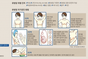 비만이 젊은 여성 유방암 유발… 30세부터 매월 자가 검진 필요