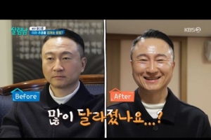 주영훈, 성형 시술 후 확 달라진 얼굴