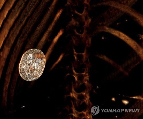 2300년 된 황금 소년 미라 컴퓨터단층촬영(CT) 사진에서 발견된 부적. EPA 연합뉴스