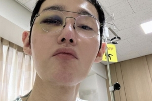새까맣게 멍든 눈…허지웅, 안와골절 수술 앞둔 근황