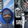 킥보드 사고난 연예인…“병원비만 80만원”