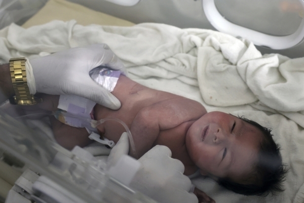 7일(현지시간) 시리아 알레포의 어린이병원에서 건물 잔해 속에서 극적으로 구조된 신생아가 치료를 받고 있다. 2023.2.8  AP연합뉴스