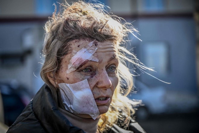 In this file photo taken on February 24, 2022 Olena Kourilo, a 52-year-old teacher stands outside a hospital after the bombing of the eastern Ukraine town of Chuguiv as Russian armed forces attempt to invade Ukraine from several directions, using rocket systems and helicopters to attack Ukrainian position in the south, the border guard service said. - Russia‘s ground forces crossed into Ukraine from several directions, Ukraine’s border guard service said, hours after President Vladimir Putin announced the launch of a major offensive. Russian tanks and other heavy equipment crossed the frontier in several northern regions, as well as from the Kremlin-annexed peninsula of Crimea in the south, the agency said. (Photo by Aris Messinis / AFP)