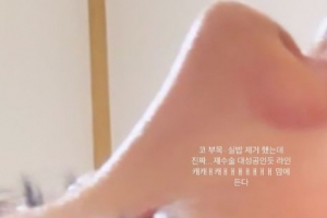 최준희 “코 재수술 성공” 사진 보니