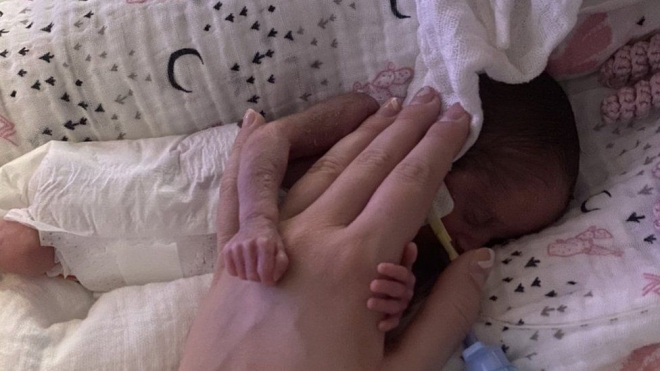 산모 레이철의 손보다 임신 22주 만에 태어난 신생아 이모겐이 작아 보인다.  이 여린 샘영이 반년을 버텨 집에 처음 왔다. 레이철 스톤하우스 제공