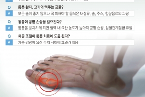 발가락·손목 등 갑자기 ‘찌릿’… 극심한 고통에 잠 못 이루는 통풍