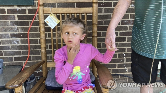 농구공 주으러 갔다 이웃의 총격으로 얼굴에 찰과상 입은 미국 6세 소녀. 연합뉴스