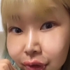 양악수술 후 확 바뀐 ‘영자’ 정신이상설 나온 사진