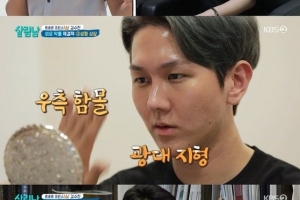 ‘코성형’ 김수찬…의사 “여자 코처럼 만들어놨다”