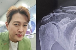 ‘빗길 사고’ 문천식 “급하게 수술, 철심 박았다”