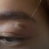 공연 한창인데…옥주현 ‘눈 주위’ 부상