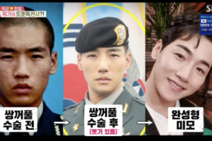 “박군, 쌍꺼풀에 코 수술 2번 했다”