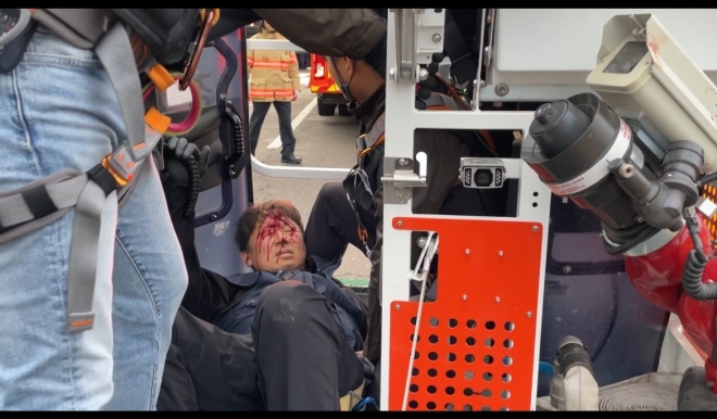 한국노총 금속노련 간부, 경찰 진압에 머리 출혈