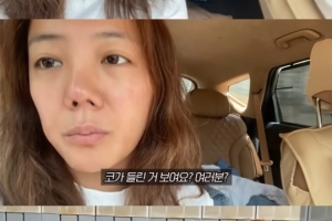 의료사고로 코 무너진 여배우 “인생 걸렸다”